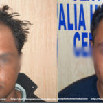 hair-transplant-image5