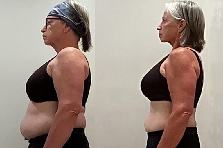 Beyond Weight Loss: Total Body Transformation with Natural Power