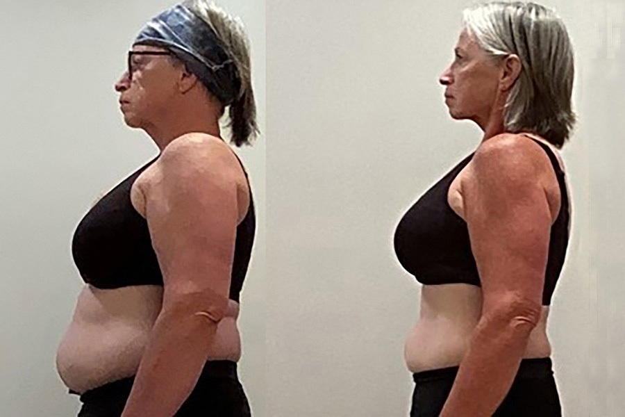 Beyond Weight Loss: Total Body Transformation with Natural Power