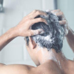 Is Hair Growth Shampoo Enough to Slow Balding
